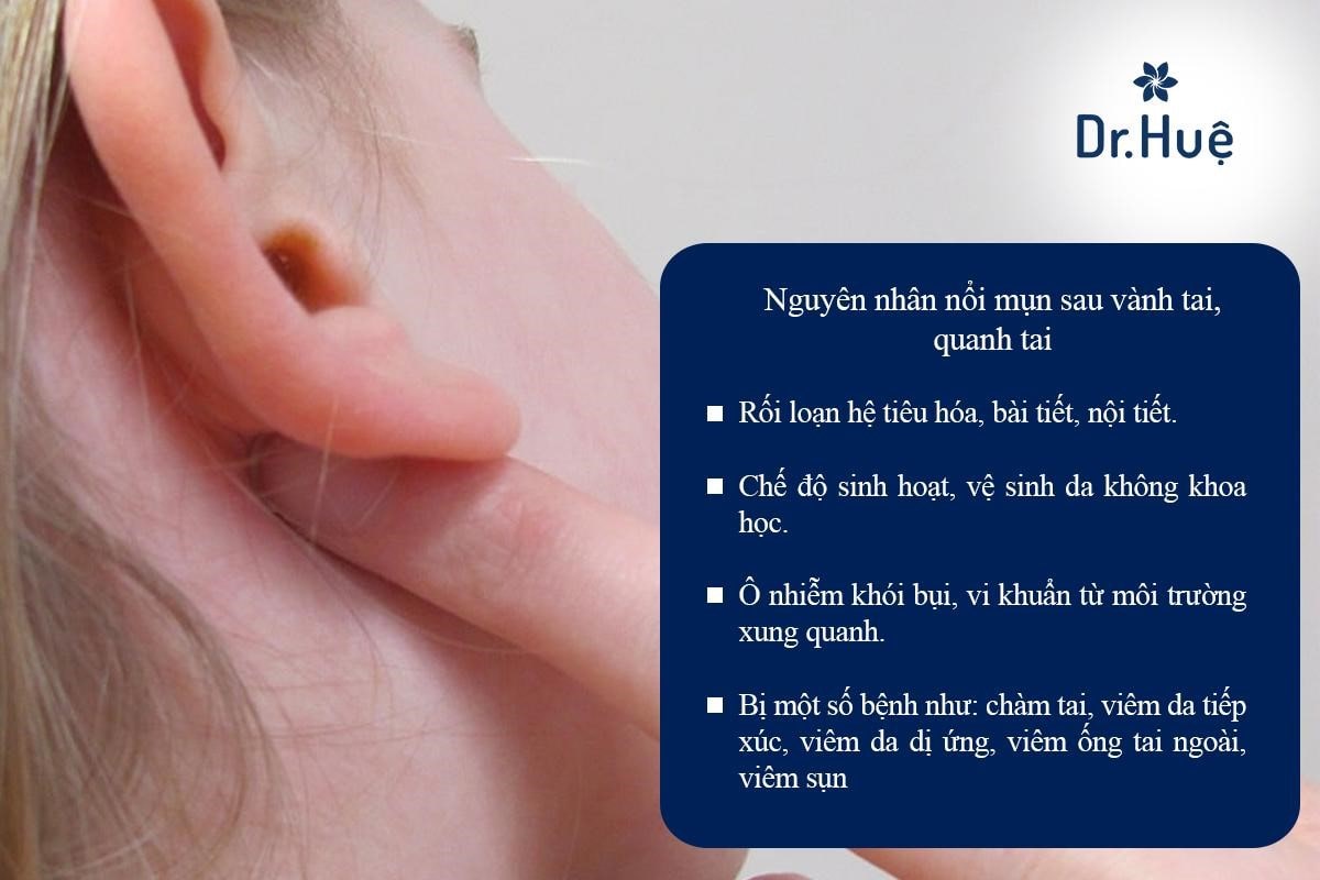 Vì sao lại bị nổi mụn ở sau vành tai và trong lỗ tai