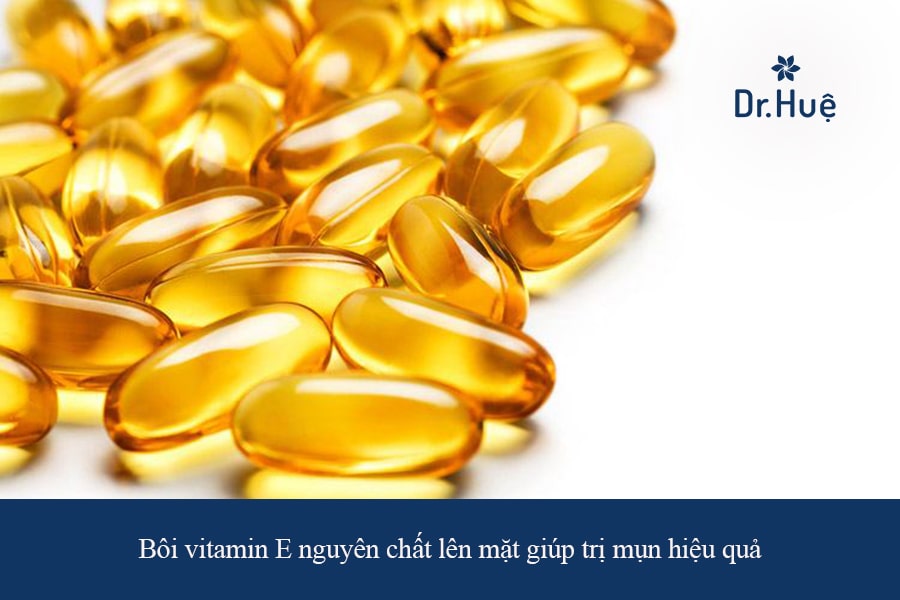 Bôi vitamin E nguyên chất lên mặt trị mụn hiệu quả