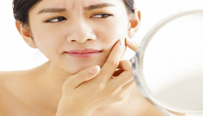 Nguyên nhân gây ra mụn ẩn là gì