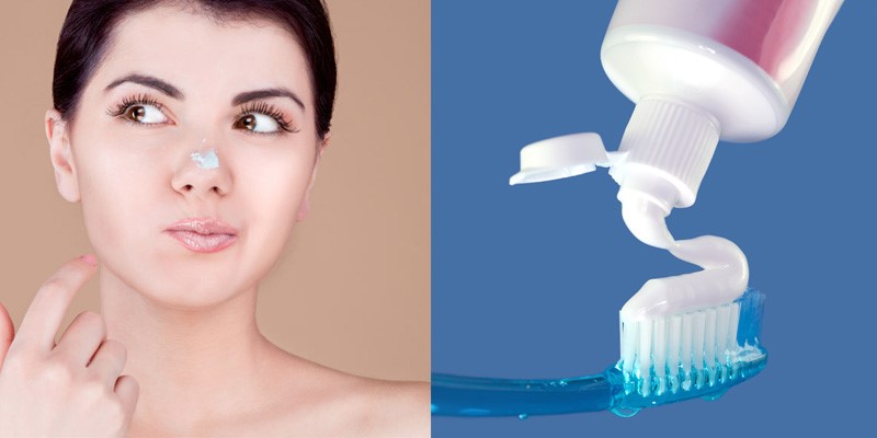 Cách trị mụn trứng ca bằng kem đánh răng