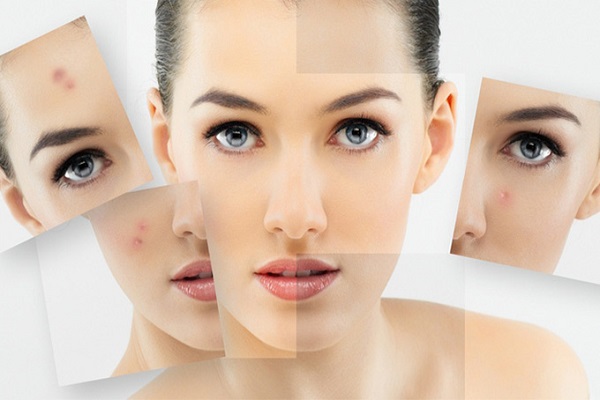 Chế độ chăm sóc da mụn trứng cá