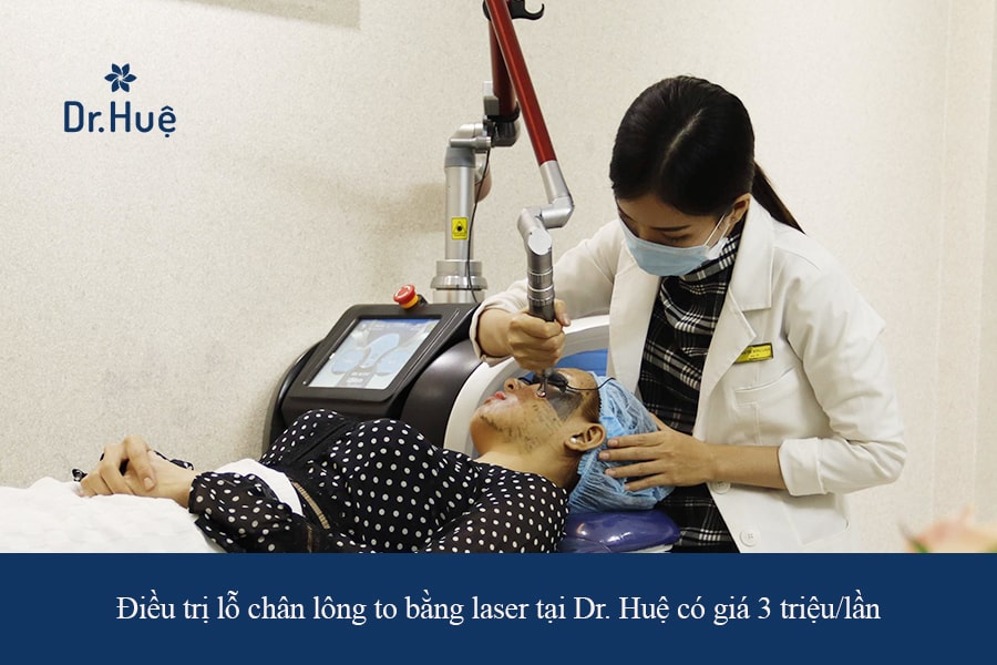 Điều trị lỗ chân lông to bằng laser giá bao nhiêu tại Dr. Huệ