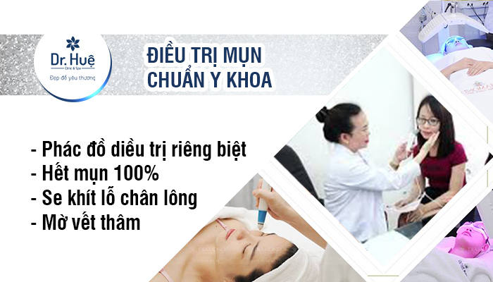 Điều trị mụn chuẩn y khoa