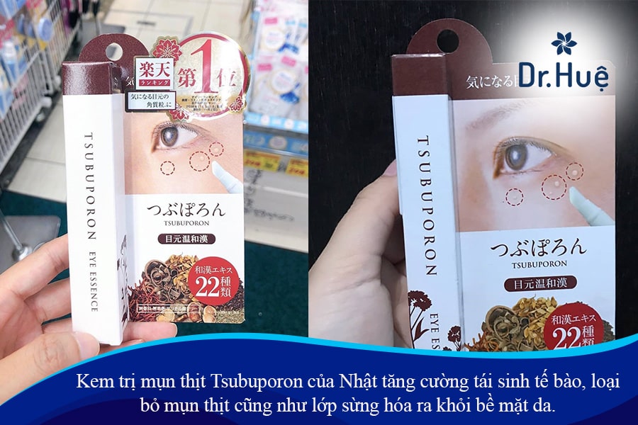 Tổng quan về kem trị mụn thịt của Nhật Tsubuporon 1.8ml