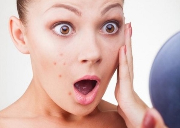 Làm gì bị mụn trứng cá