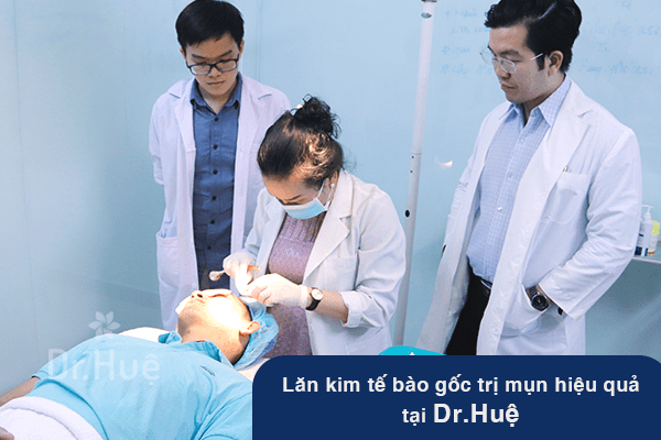 Điều trị mụn hiệu quả chuẩn y khoa theo liệu trình lăn kim tại Dr. Huệ