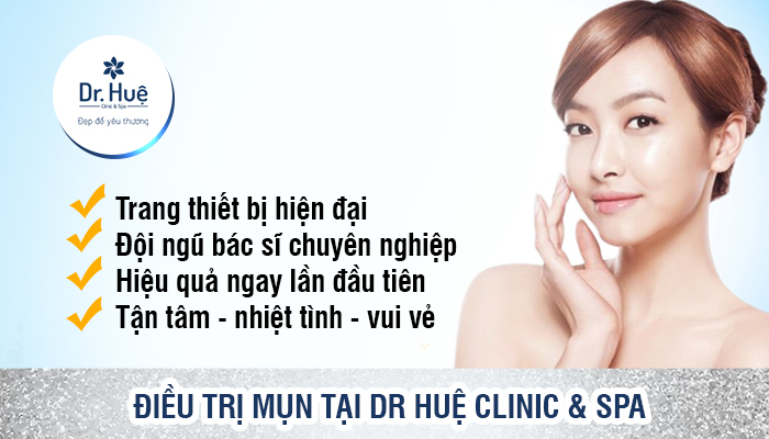 Lý do bạn nên chọn điều trị mụn tại Dr. Huệ