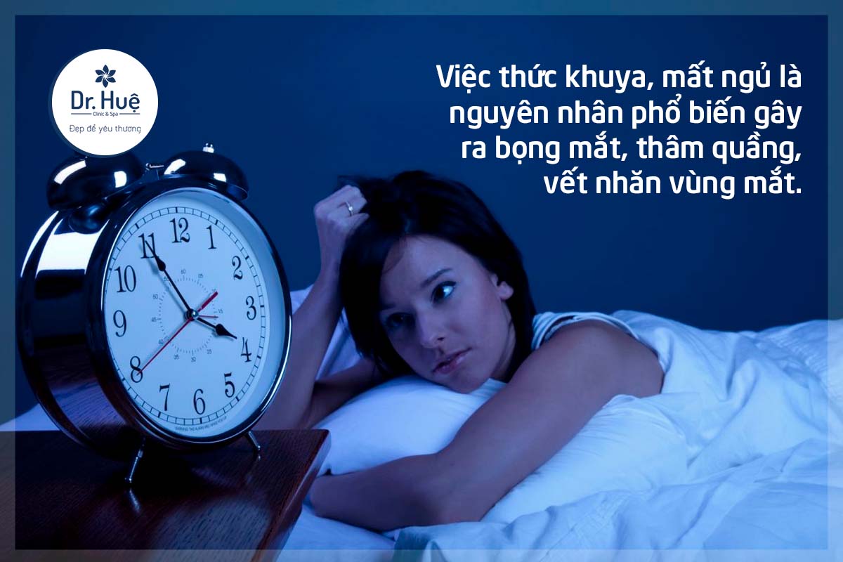 Thức khuya mất ngủ cũng là nguyên nhân dẫn đến vùng mắt bị nhăn thâm quầng