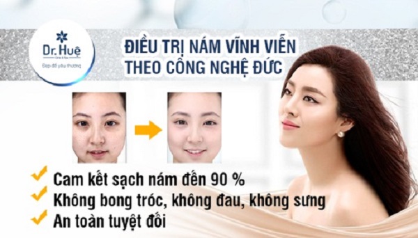 Dr. Huệ địa chỉ điều trị nám và tàn nhang tốt nhất