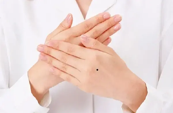 Nốt ruồi trên mu bàn tay trái phụ nữ có ý nghĩa gì