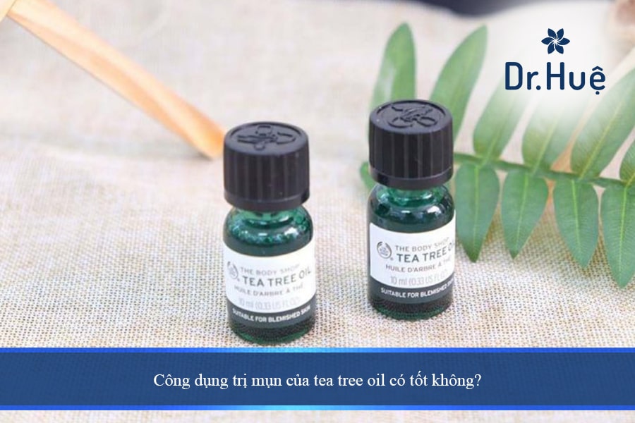 Công dụng trị mụn của tea tree oil có tốt không?