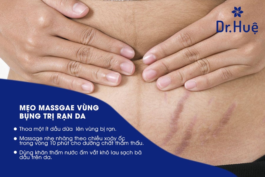 Massage cũng là cách để trị rạn da sau sinh hiệu quả